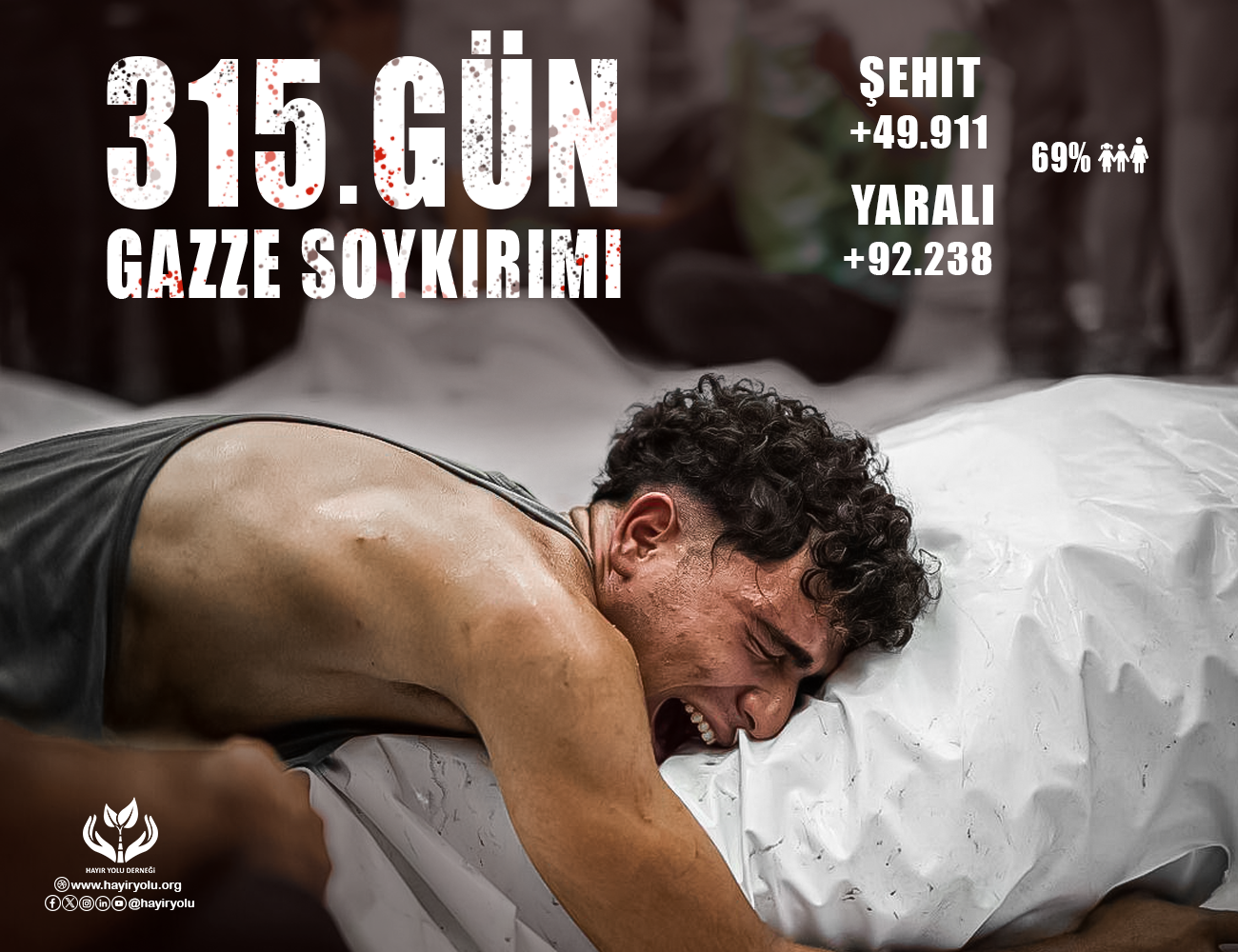 315. Gün Gazze Soykırımı