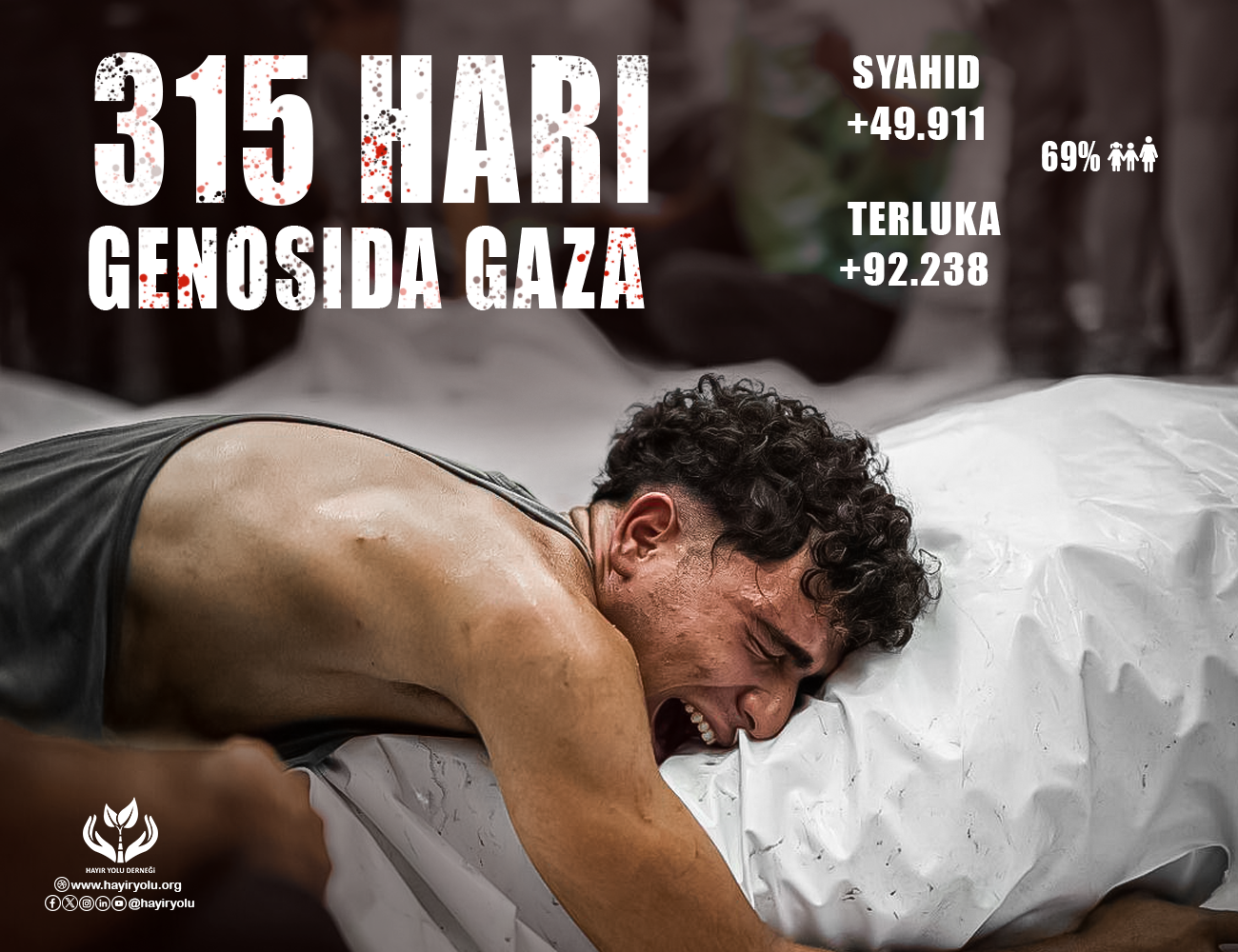 315 Hari Genosida Gaza