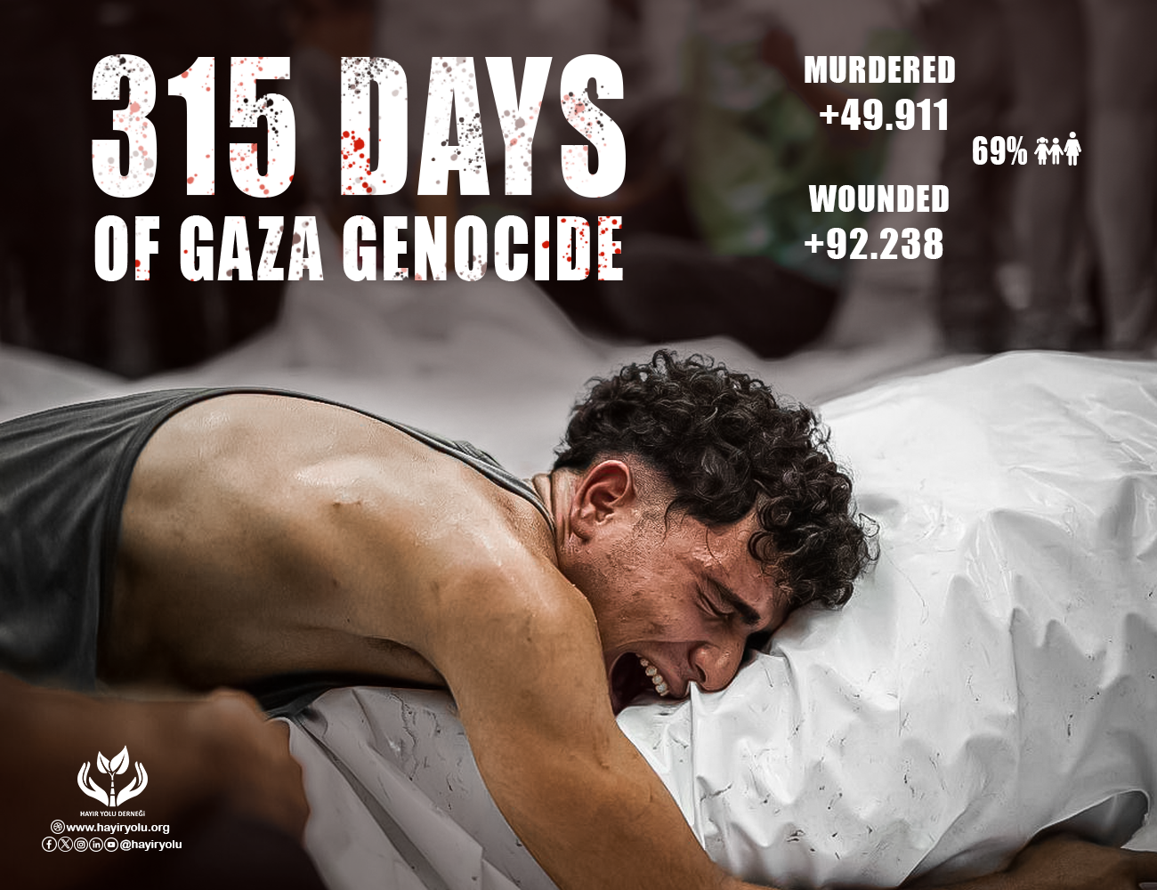 315 Days of Gaza Genocide